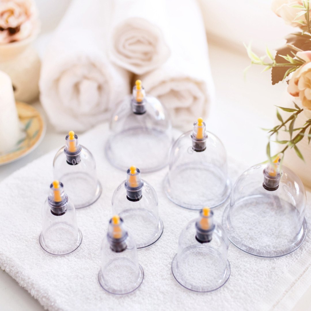 What is Hijama Cupping Therapy? 2